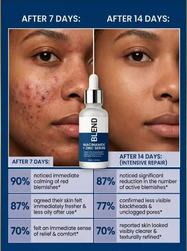 Niacinamide Serum for Acne Marks and Oil Control