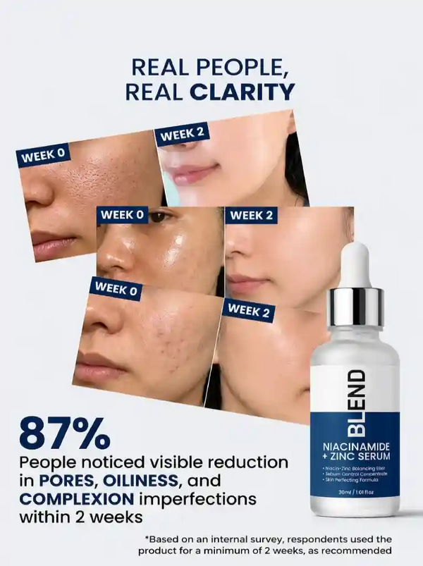 Best Niacinamide Serum for Enlarged Pores