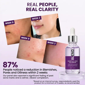 Salicylic Acid 2% Blemish Clarifying Serum | BLEND