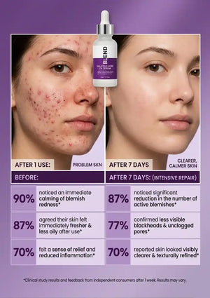 Salicylic Acid 2% Blemish Clarifying Serum | BLEND