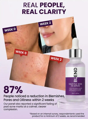 Before and after results of BLEND Salicylic Acid serum for blemishes